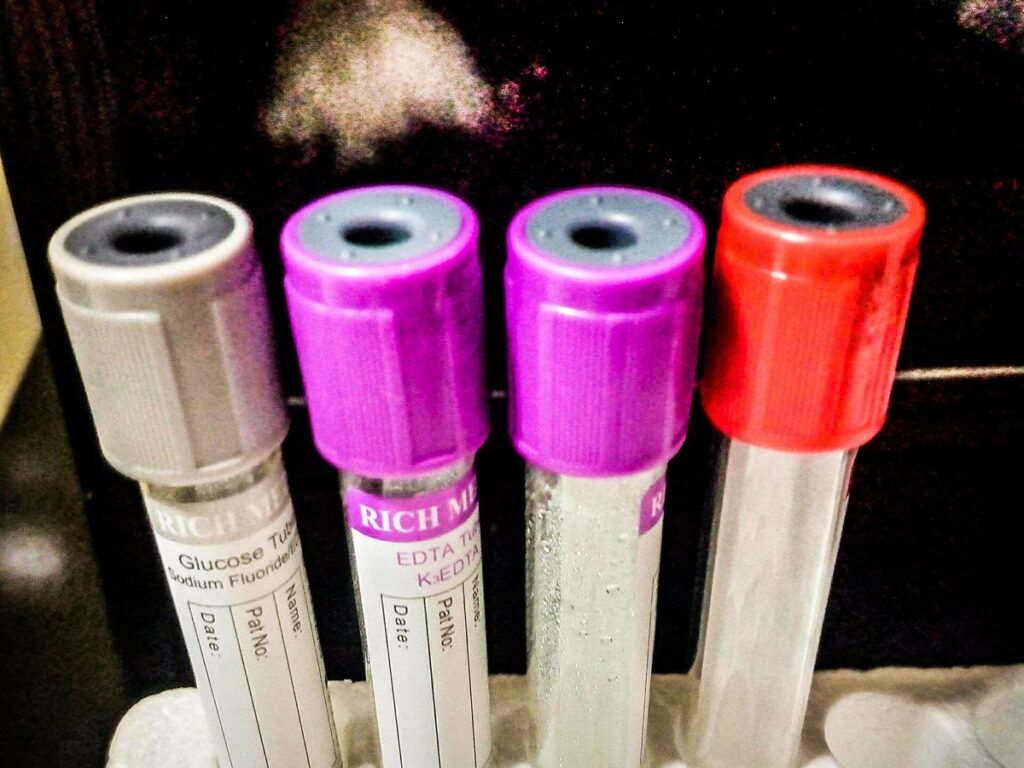Laboratory Test Tubes; from a medical laboratory in Abuja, Nigeria